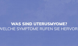 Was sind Uterusmyome? Welche Symptome rufen sie hervor?