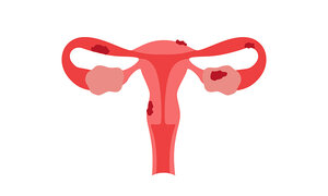 Efficient Stimulation