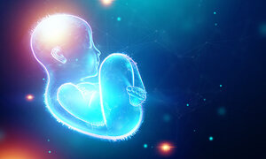 Can´t get you out of my MYOM head