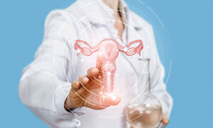 Endometriose - umfassende Effekte des Schlüsselhormons Östrogen