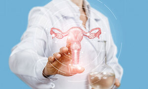 FertiClub Germany: PCOS - Mythen und Fakten