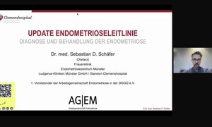 Die neue S2K-Leitlinie zur Endometriose