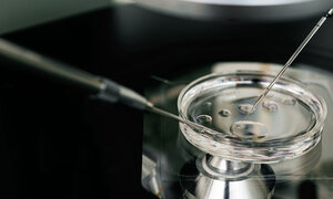 In Vitro Fertilisation – Was geschieht da?